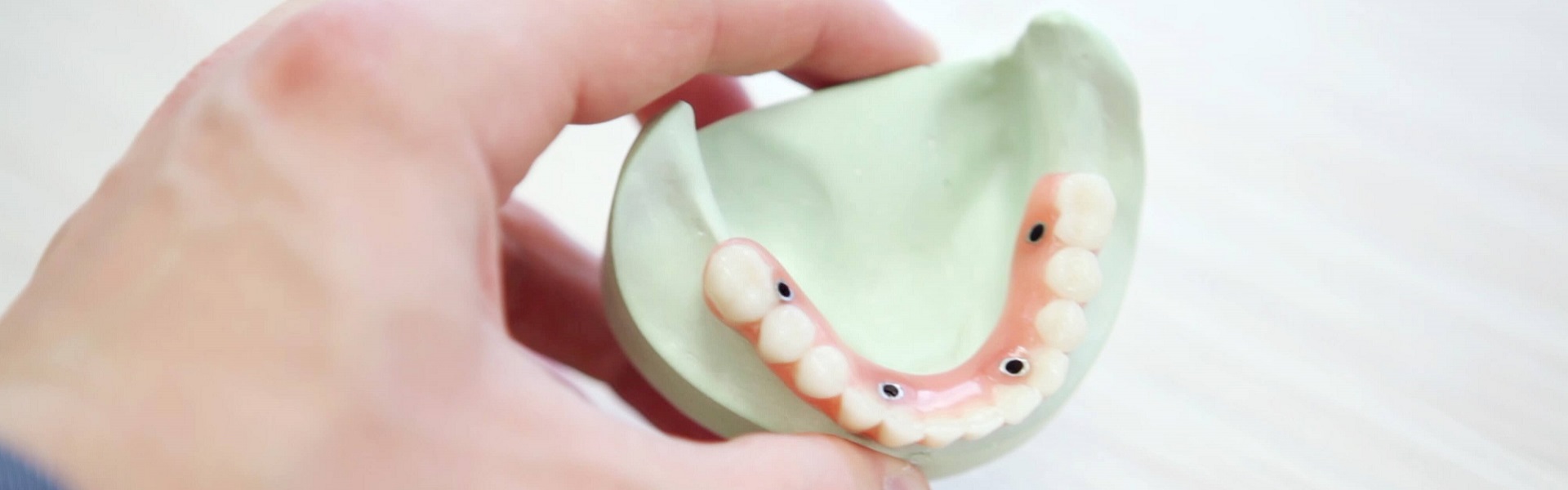 Estetska hirurgija | Zubna tehnika