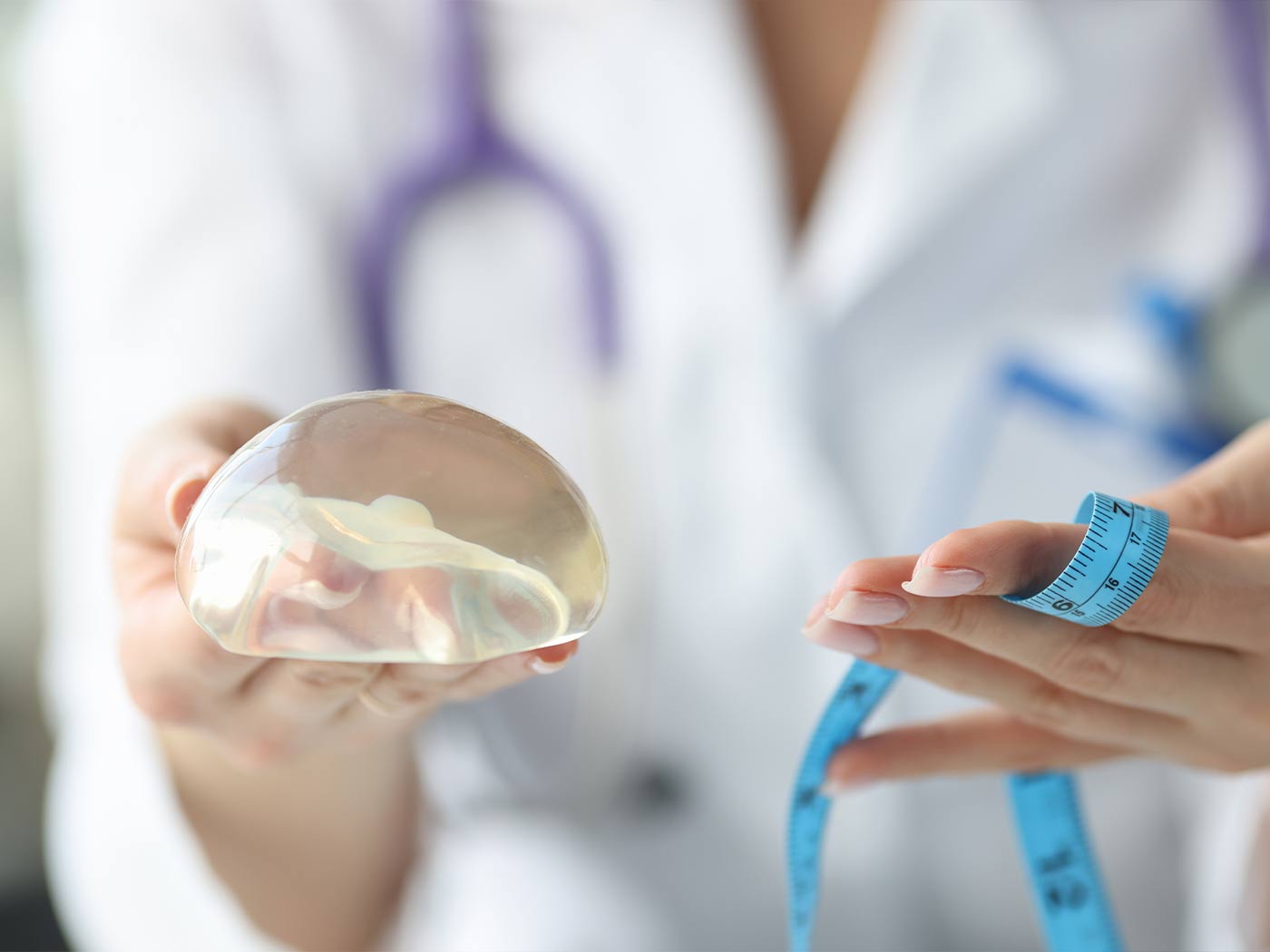 Plastic surgery | Mentor implant experiences