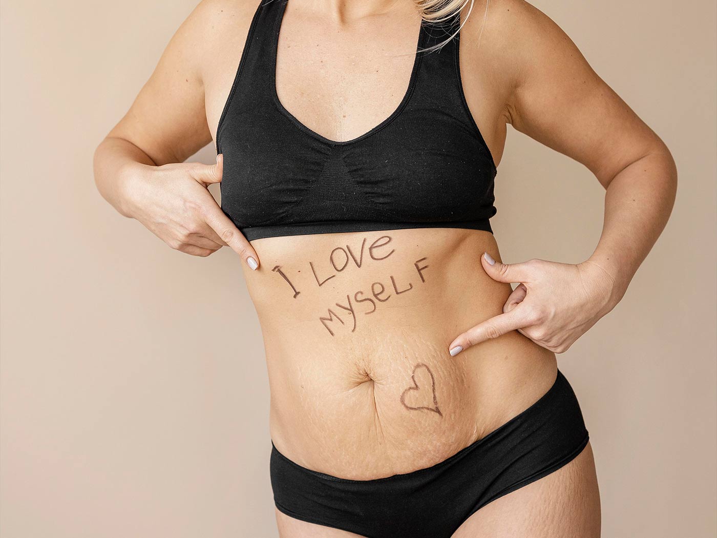 Estetska hirurgija | Mommy Makeover operacija