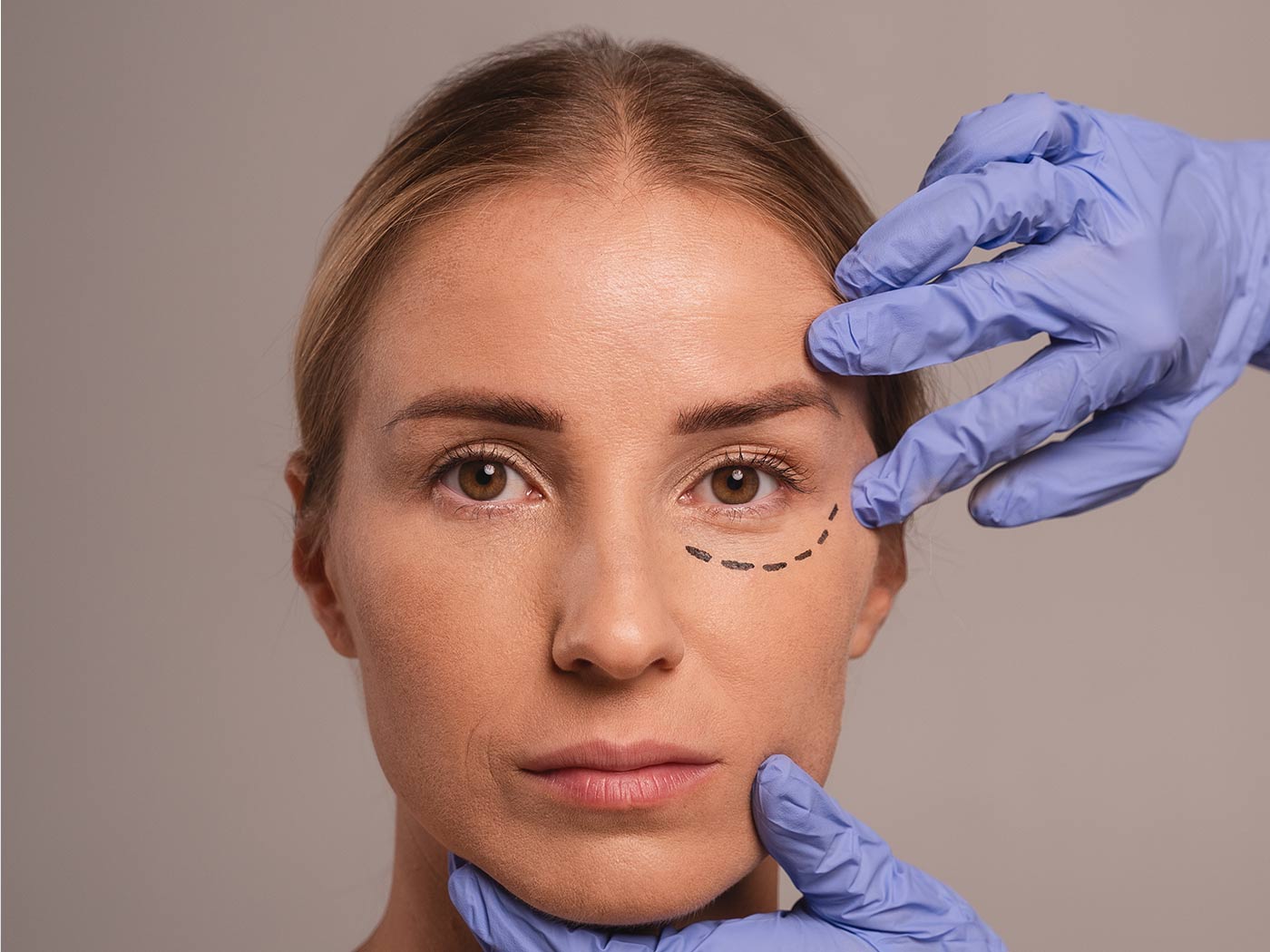 Plastic surgery | Eyelid surgery price