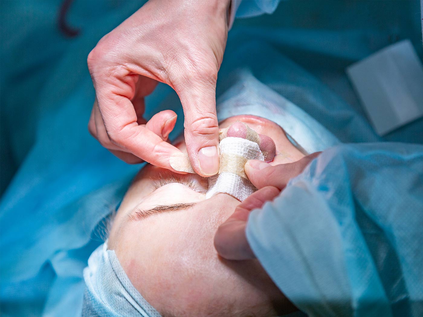 Plastic surgery | How long does nose deviation surgery take?