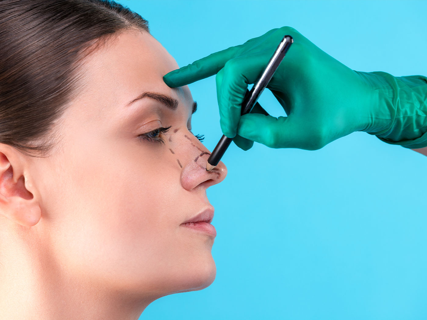 Plastic surgery | Rhinoplasty - price