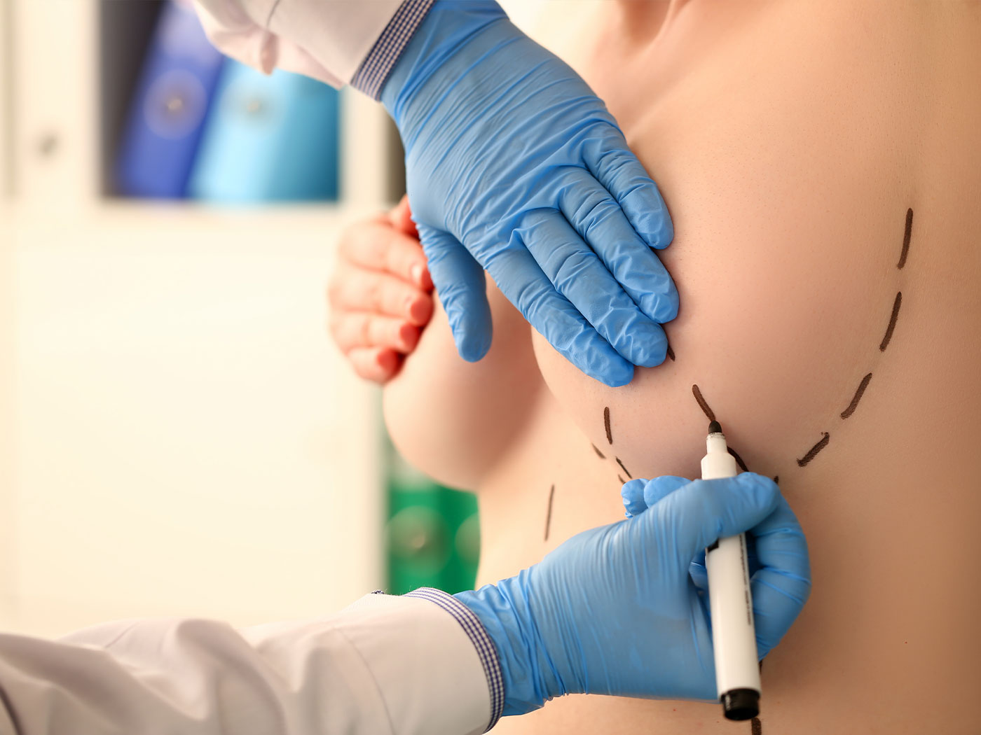 Plastic surgery | Silicone breast implants