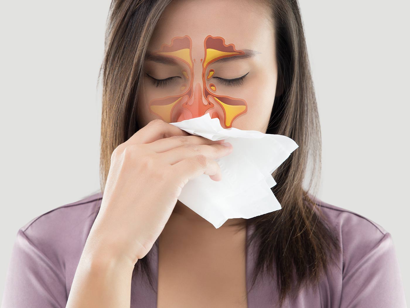 Plastic surgery | Sinus surgery