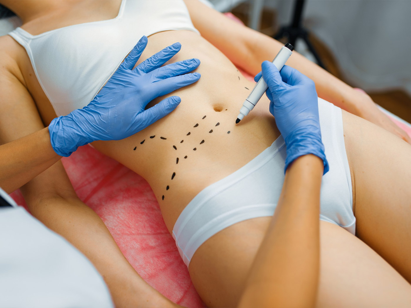 Plastic surgery | What is liposuction and how does it work?