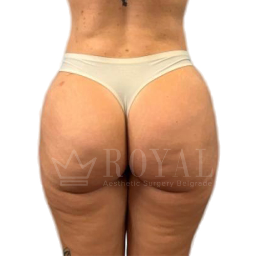 Естетска хирургија | Пре и после