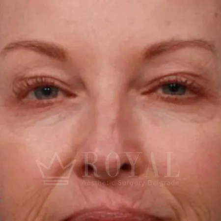 Plastic surgery | Gallery 346