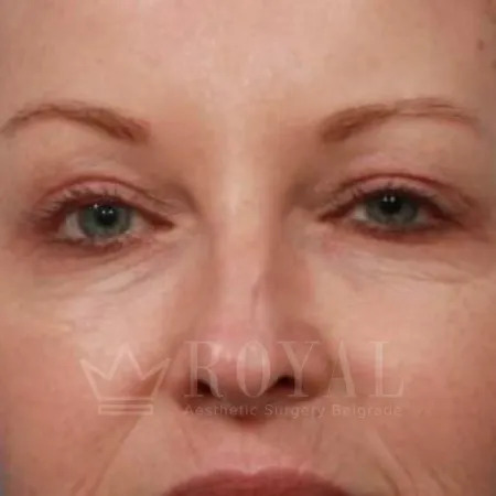 Plastic surgery | Gallery 346
