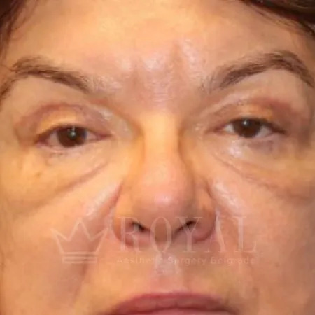 Plastic surgery | Gallery 347
