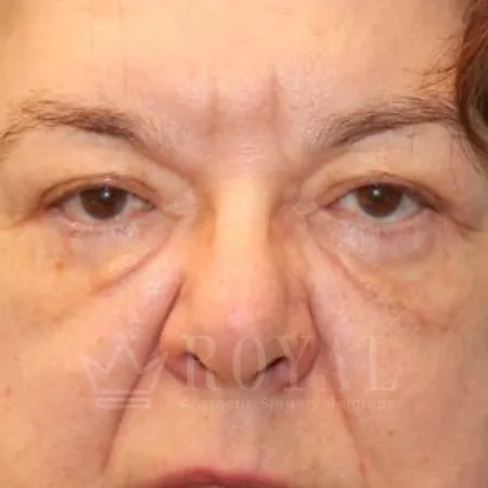 Plastic surgery | Gallery 347