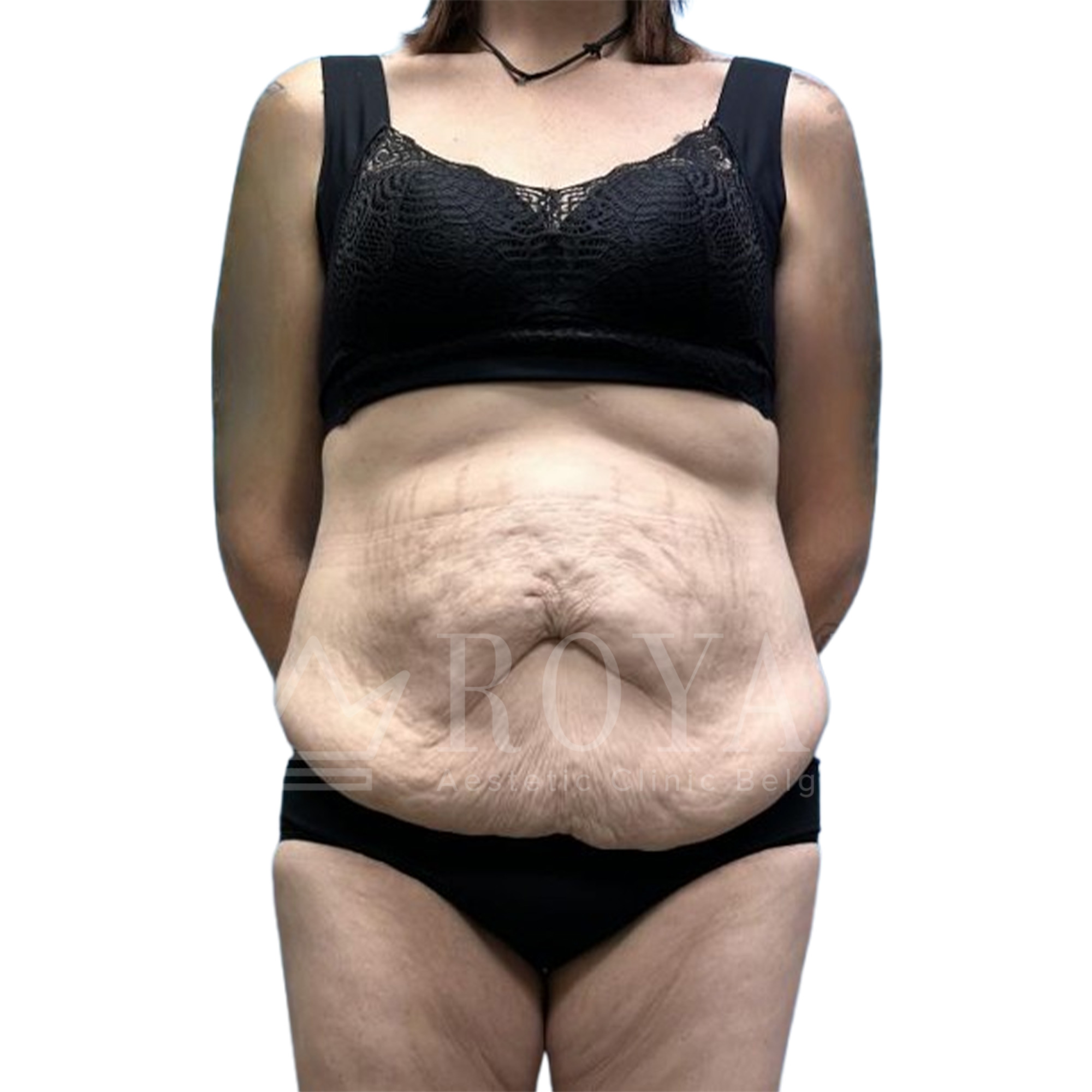 Plastic surgery | Before and after