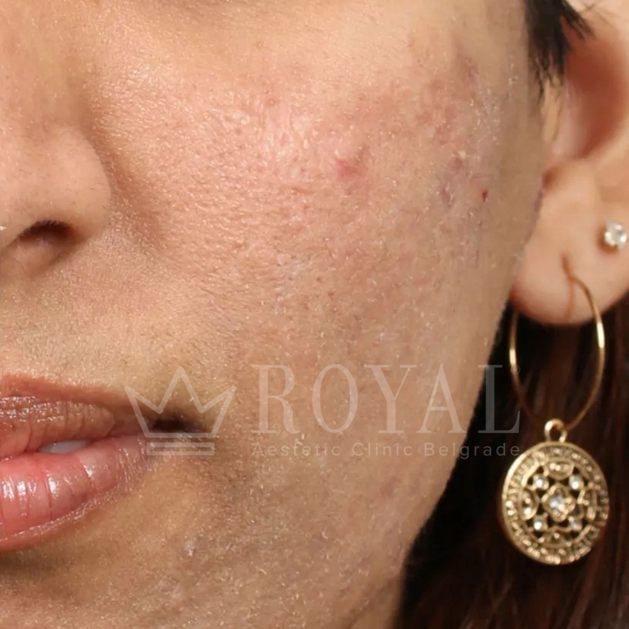 Plastic surgery | Before and after