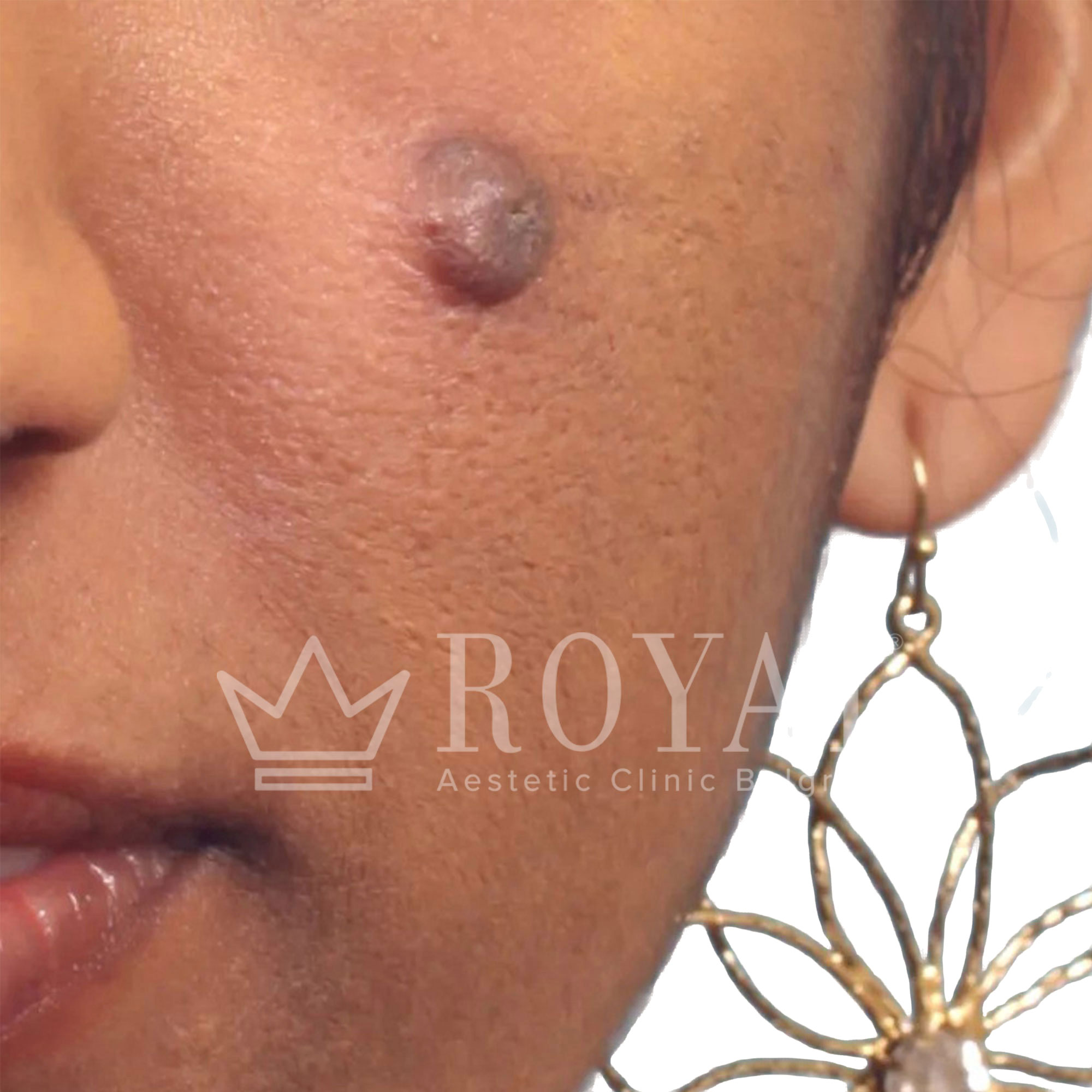 Plastic surgery | Before and after
