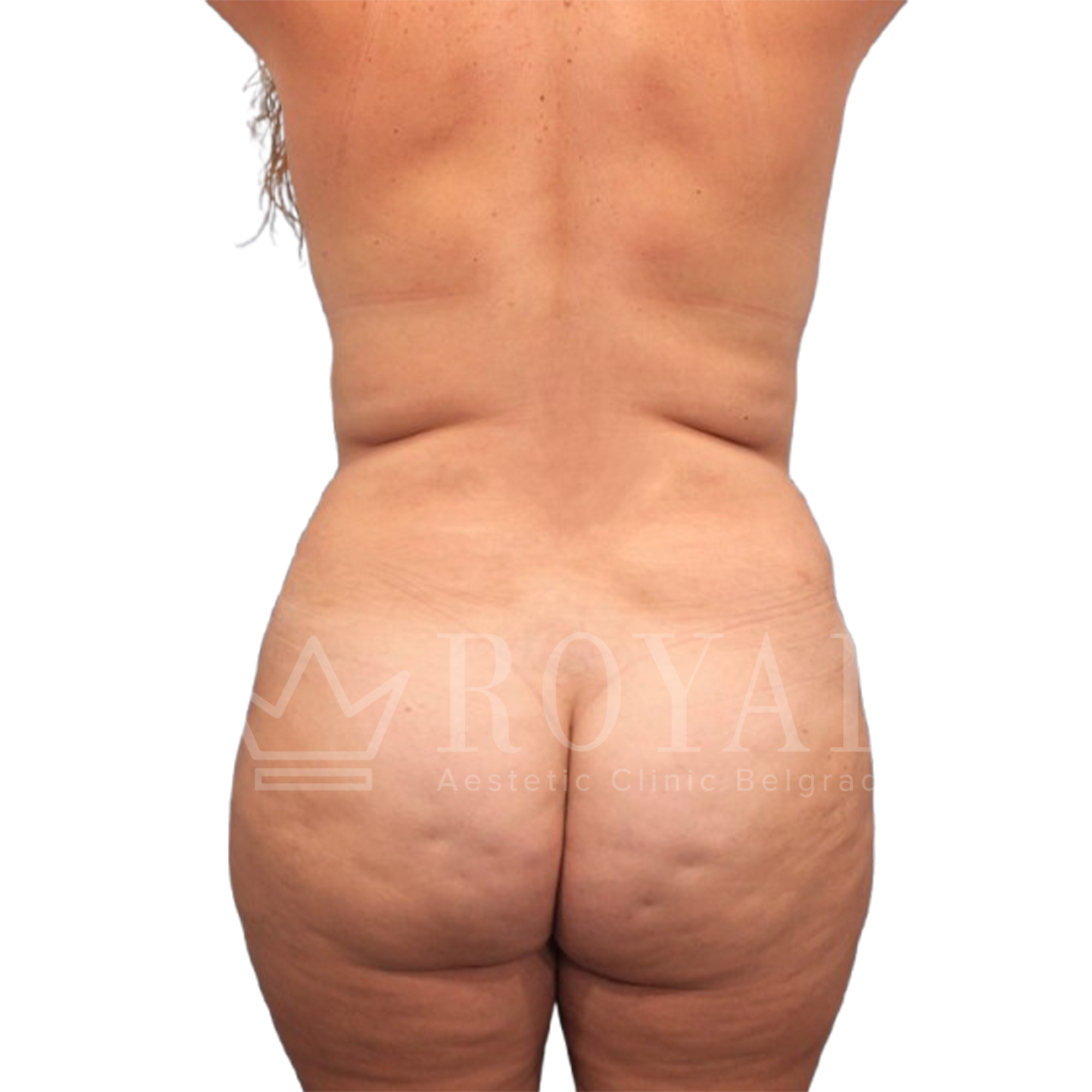 Plastic surgery | Before and after