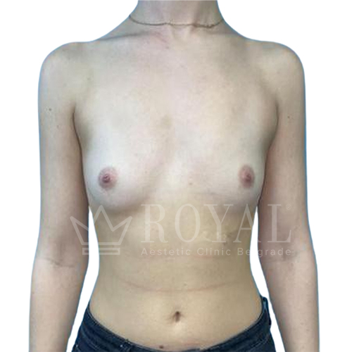Plastic surgery | Before and after