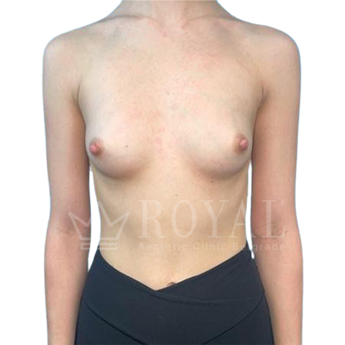 Plastic surgery | Before and after