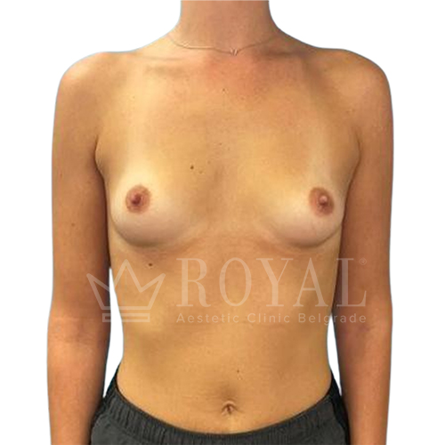Plastic surgery | Before and after