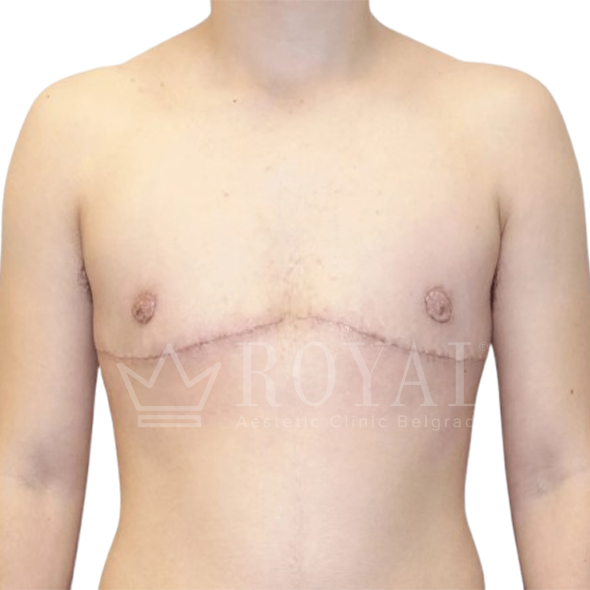 Plastic surgery | Before and after