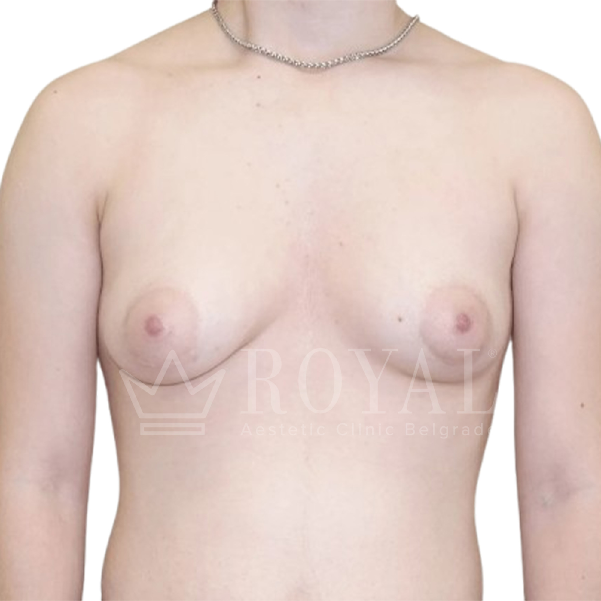 Plastic surgery | Before and after