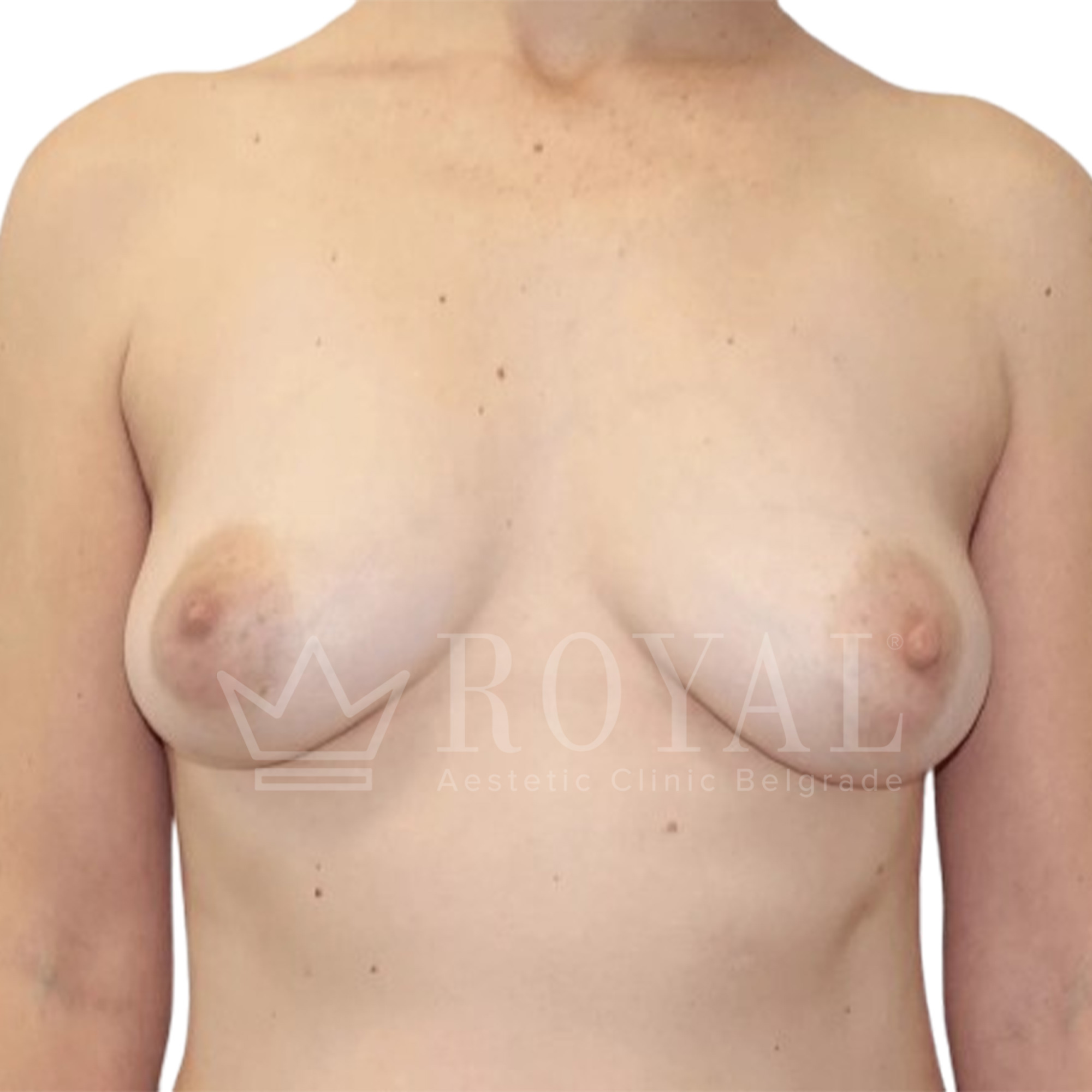 Plastic surgery | Before and after