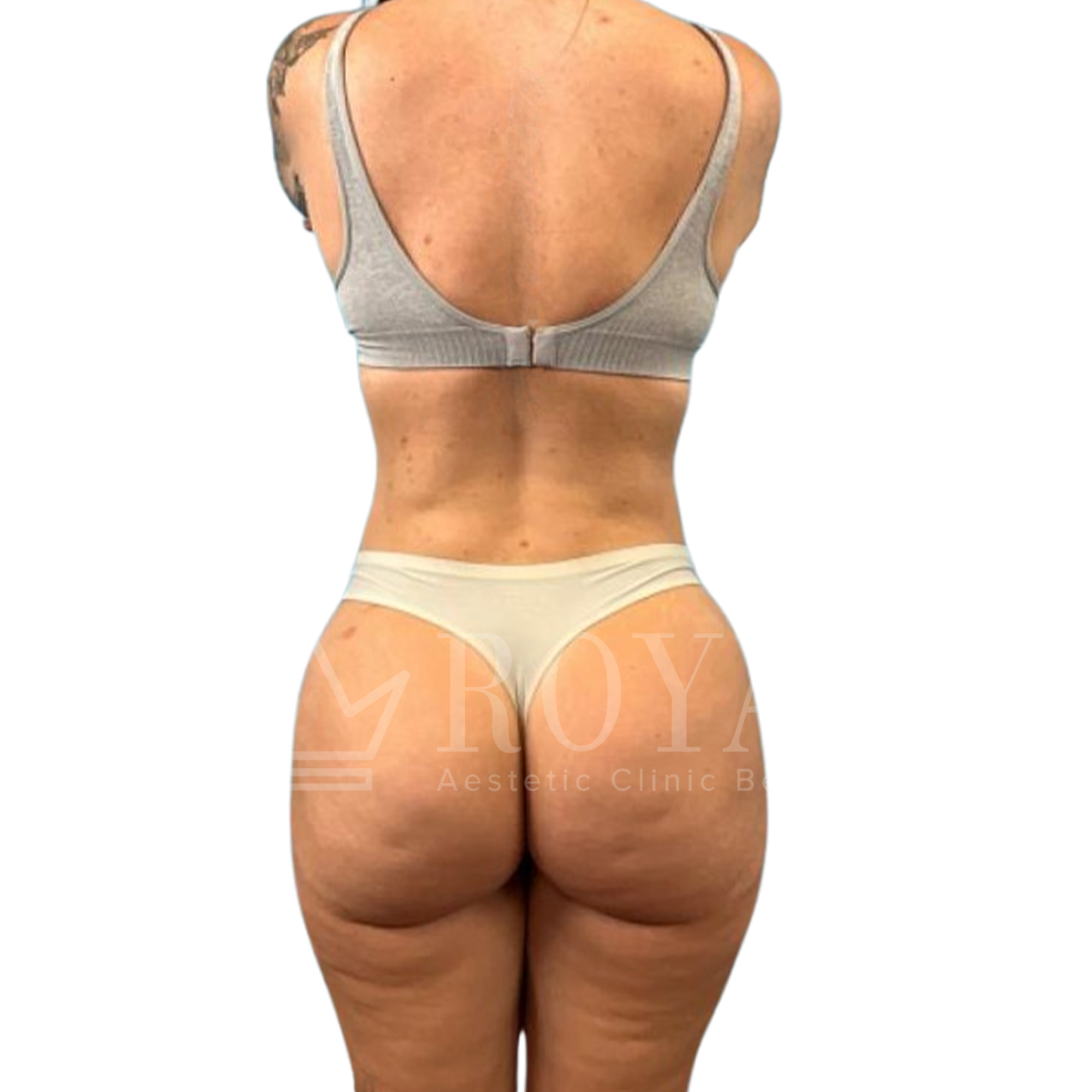 Plastic surgery | Before and after