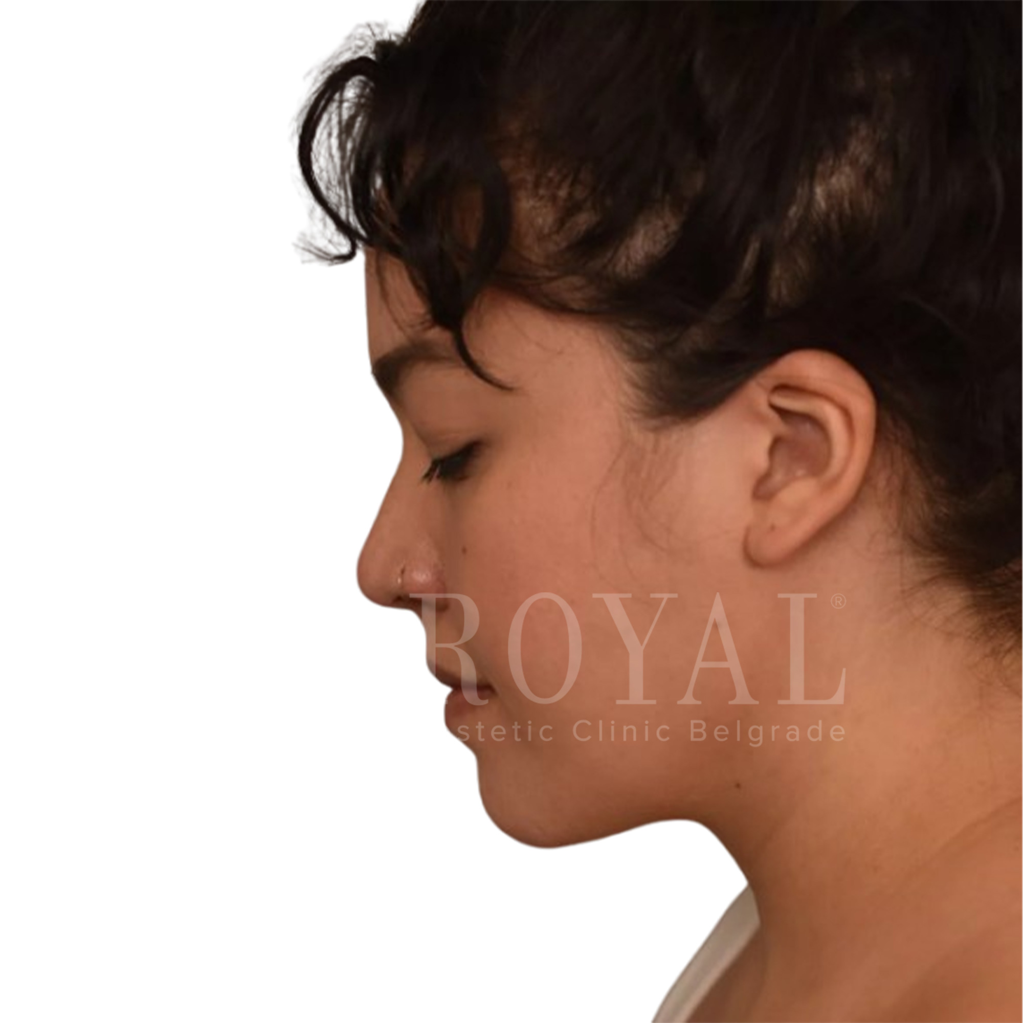 Plastic surgery | Before and after