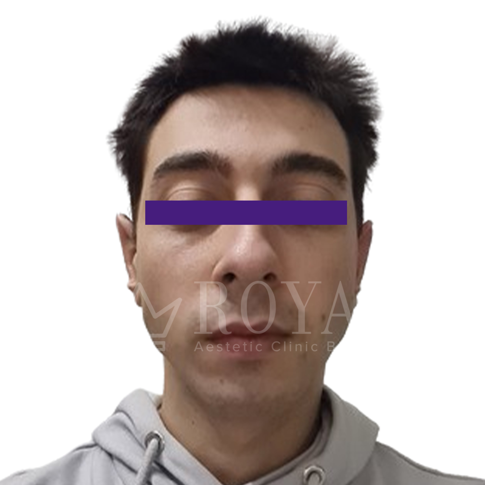 Plastic surgery | Before and after