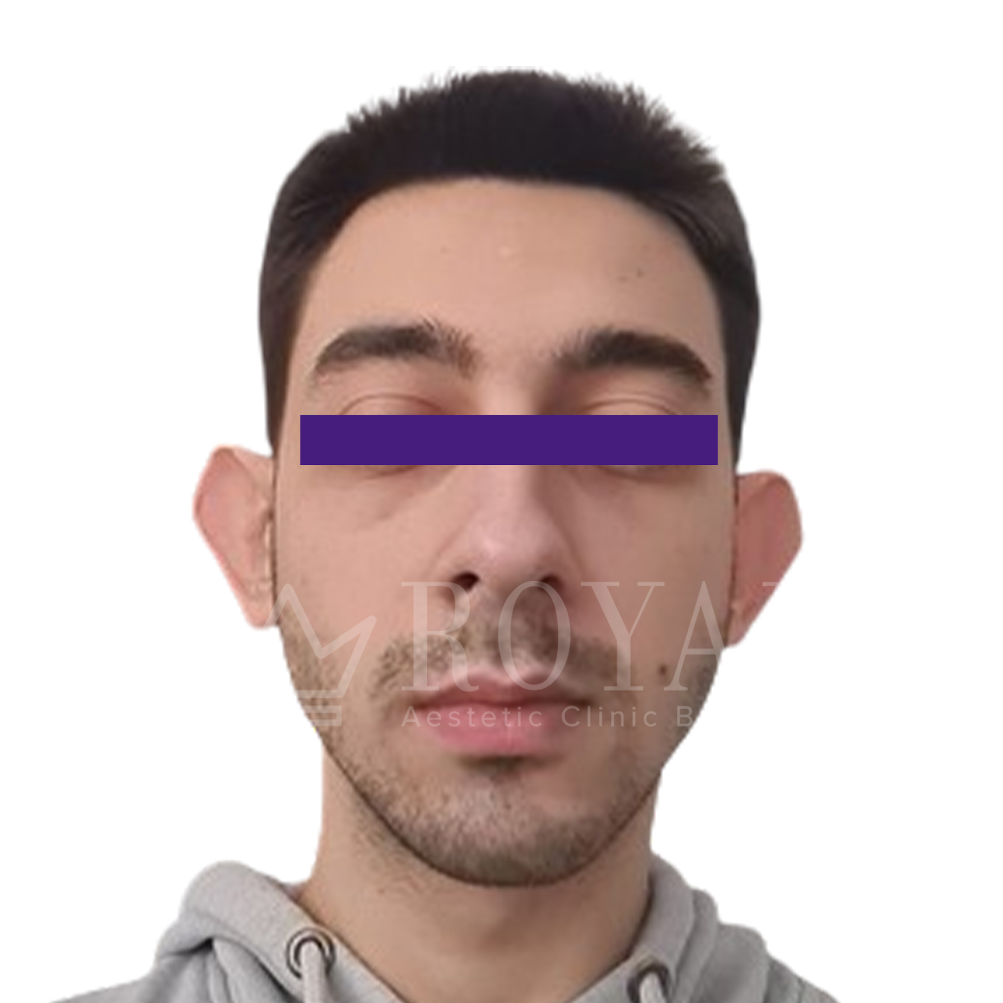 Plastic surgery | Before and after