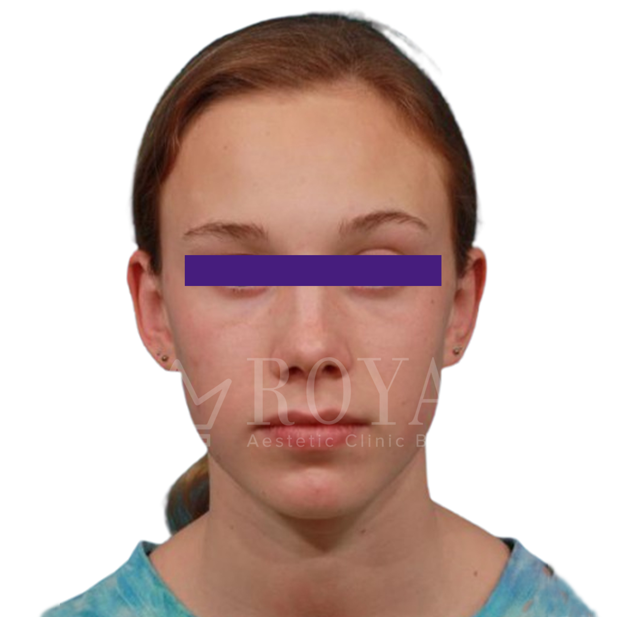 Plastic surgery | Before and after