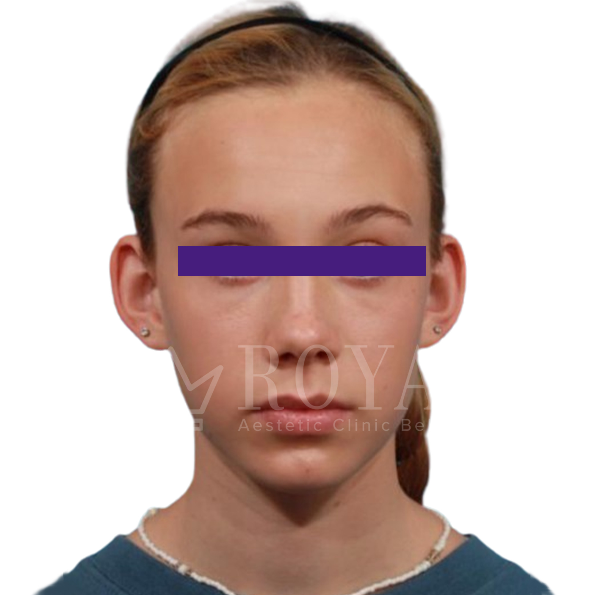 Plastic surgery | Before and after