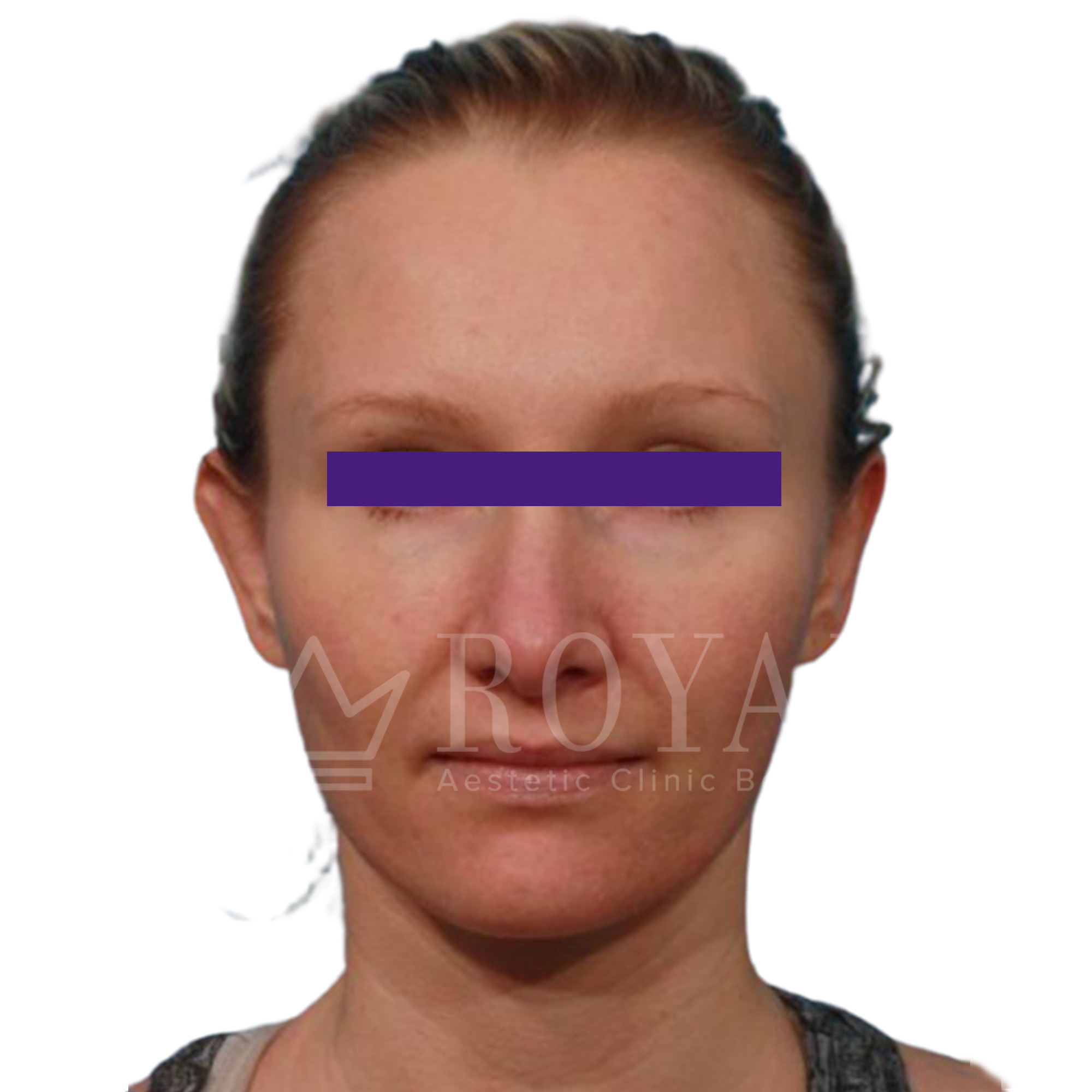 Plastic surgery | Before and after