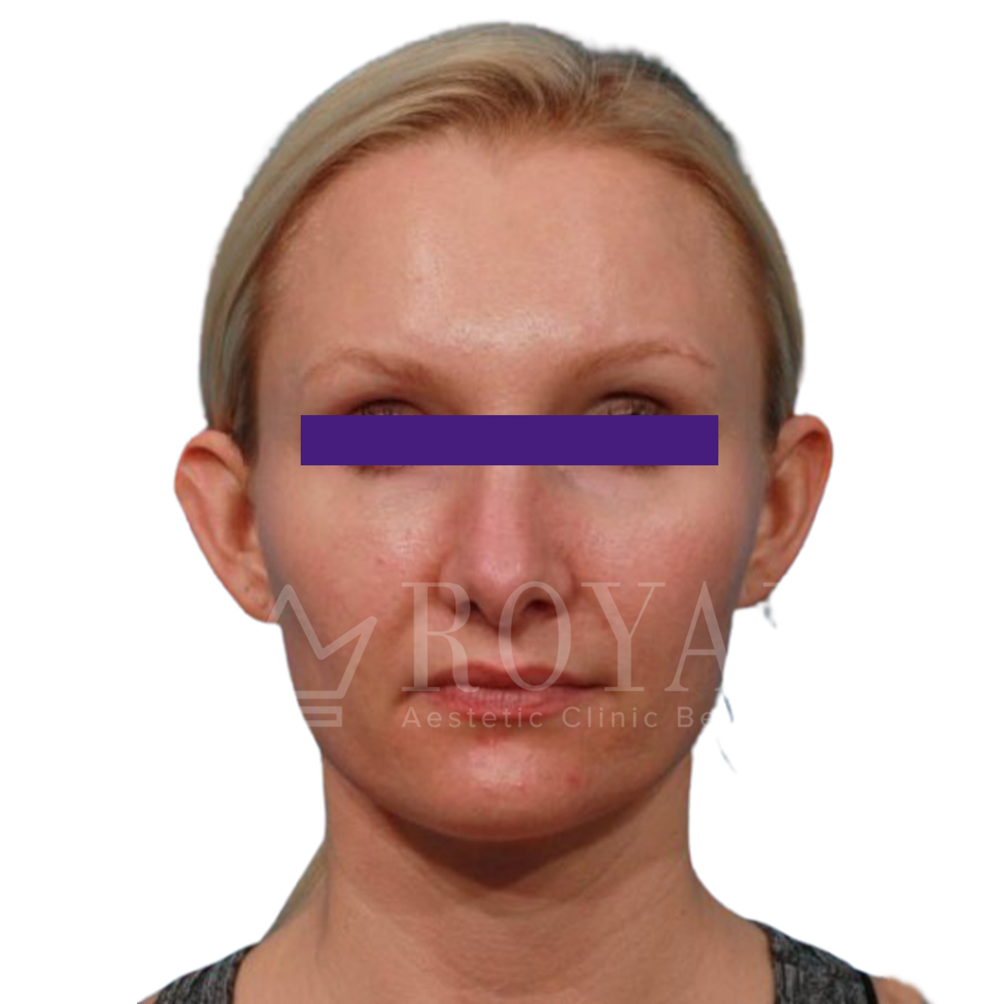 Plastic surgery | Before and after