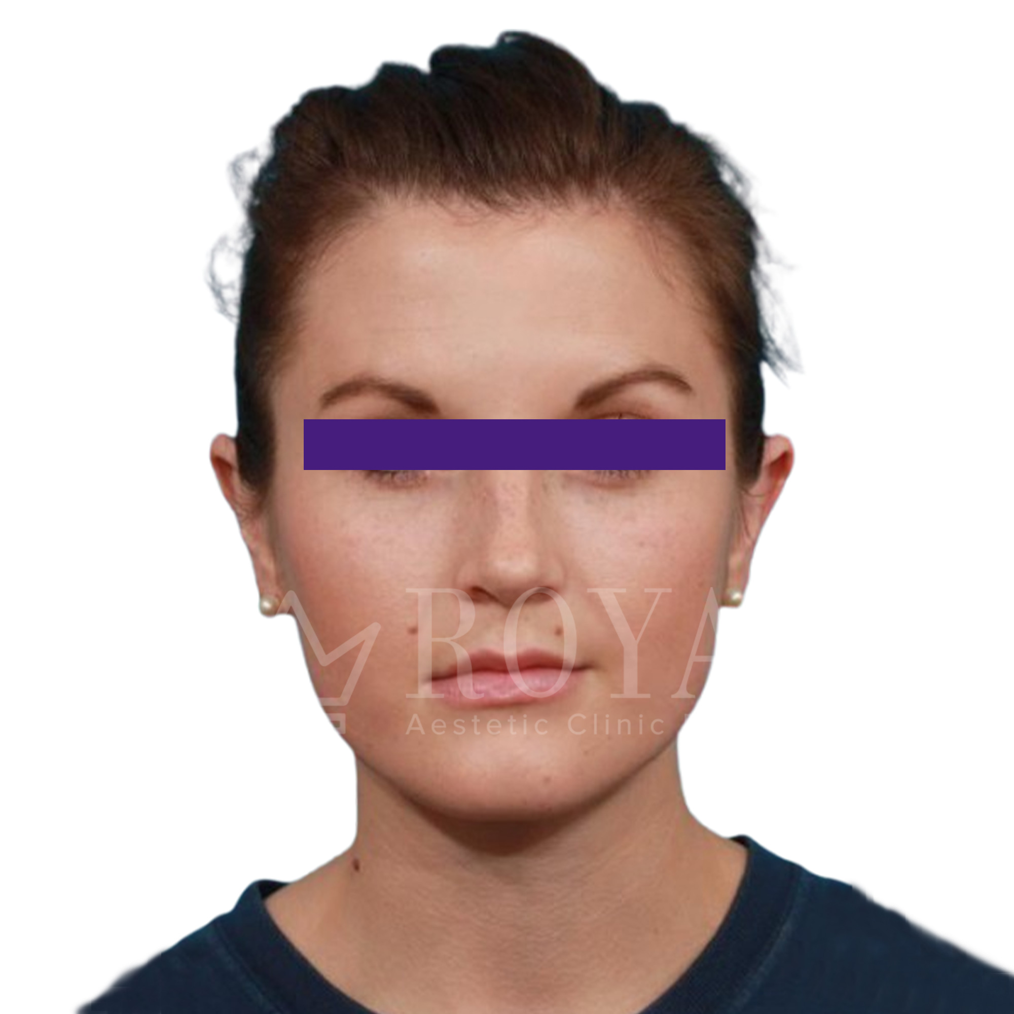 Plastic surgery | Before and after