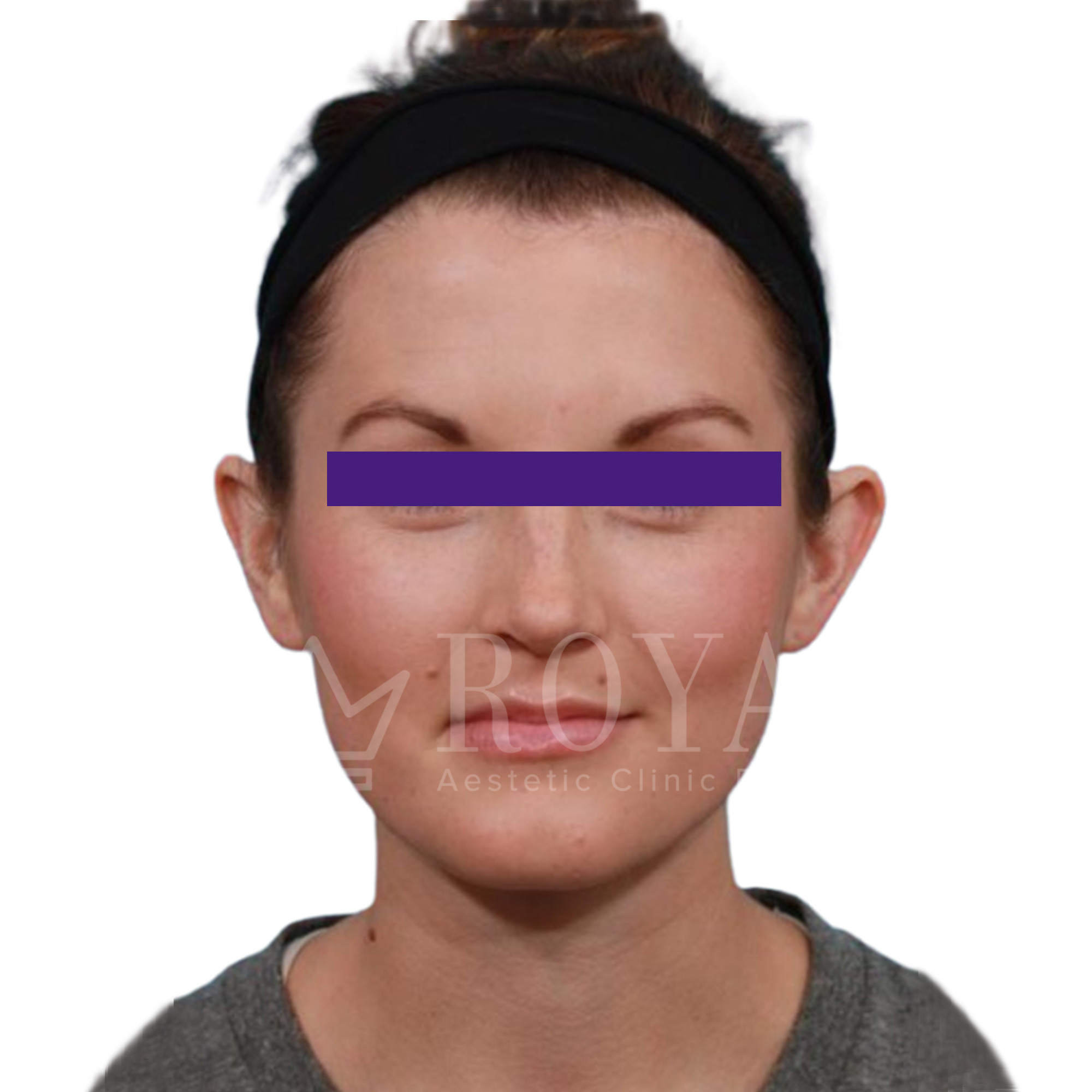 Plastic surgery | Before and after