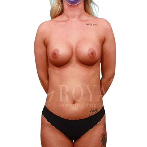Plastic surgery | Before and after