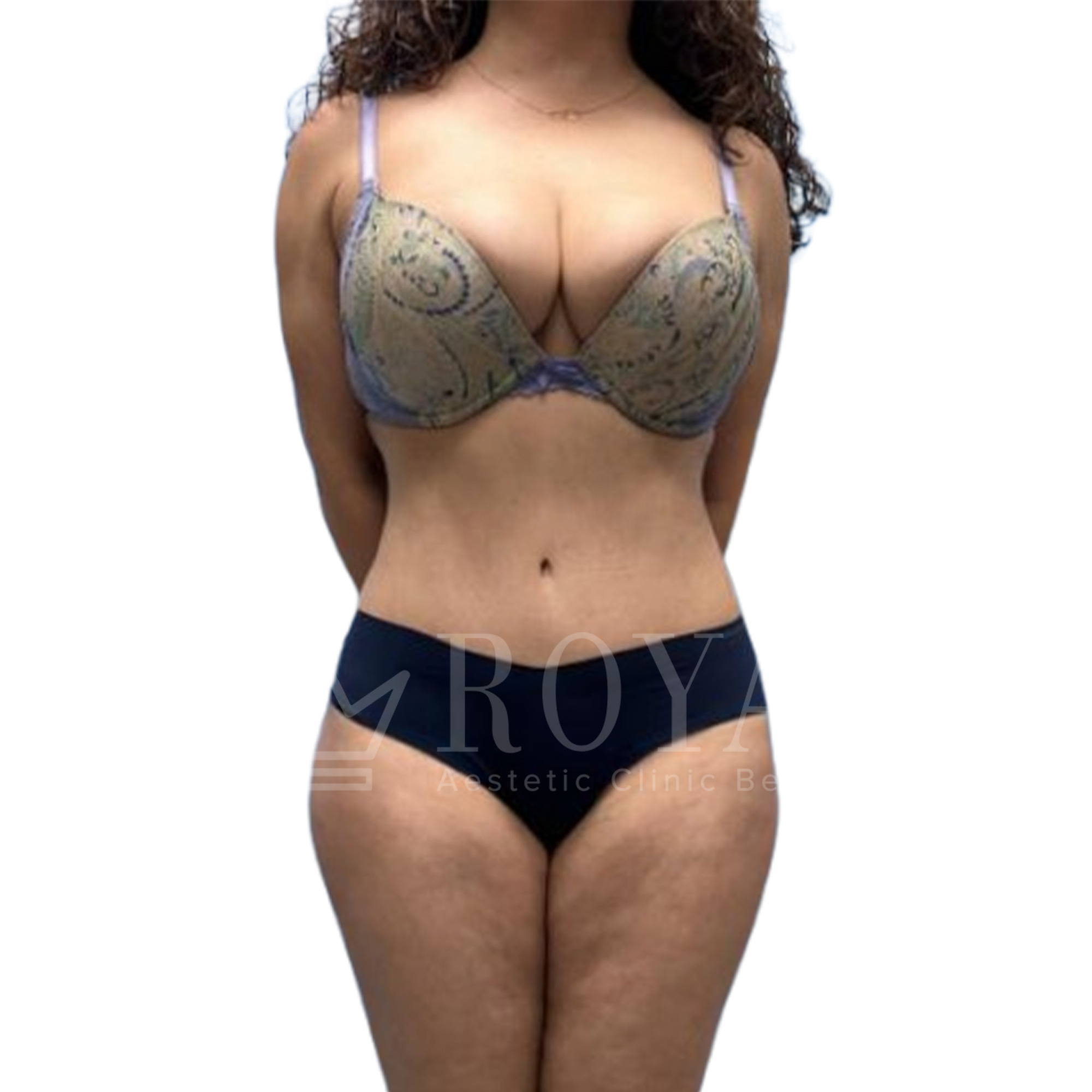 Plastic surgery | Before and after