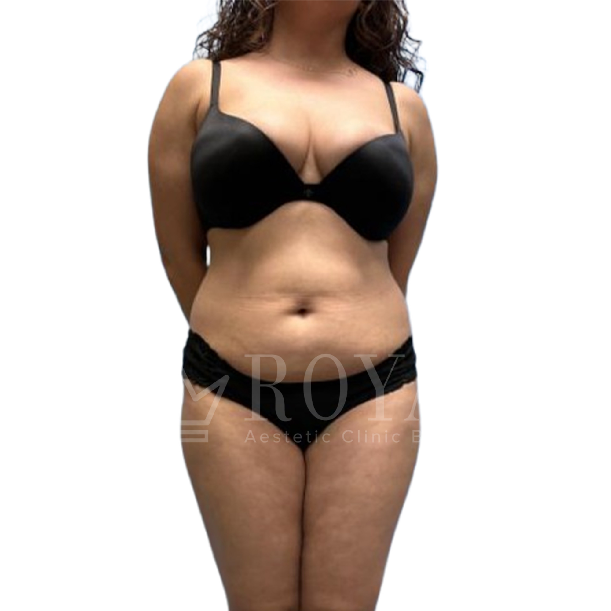 Plastic surgery | Before and after