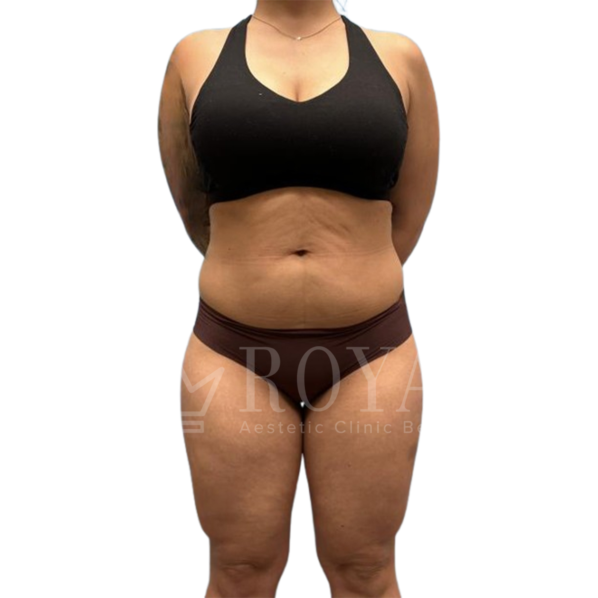 Plastic surgery | Before and after