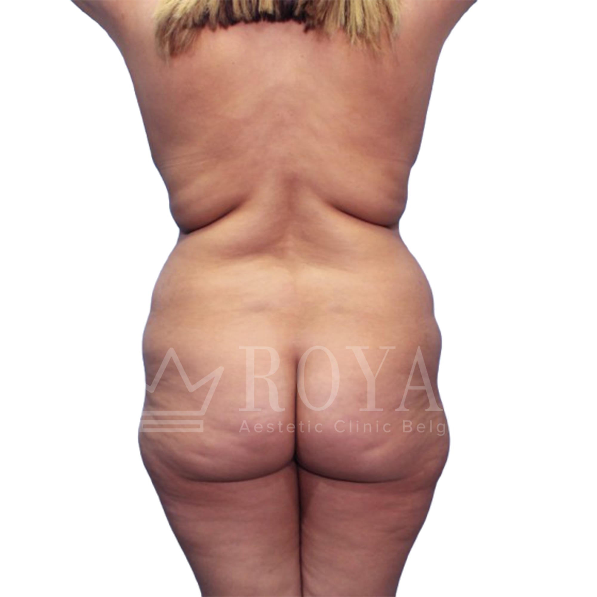 Plastic surgery | Before and after