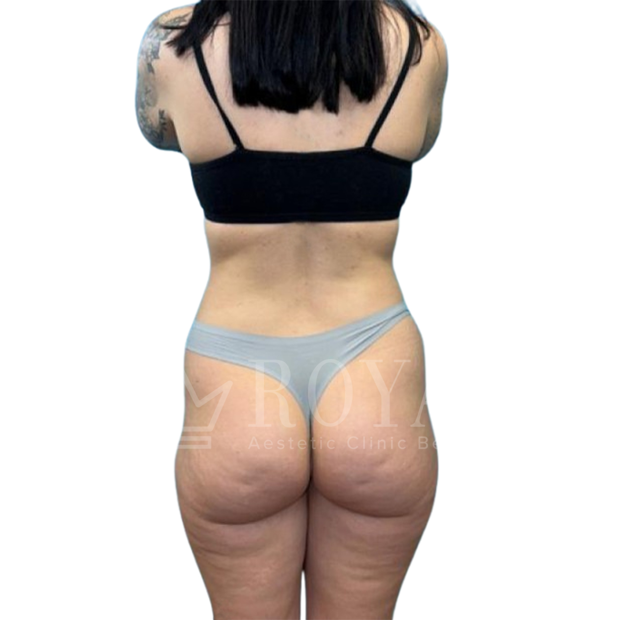 Plastic surgery | Before and after