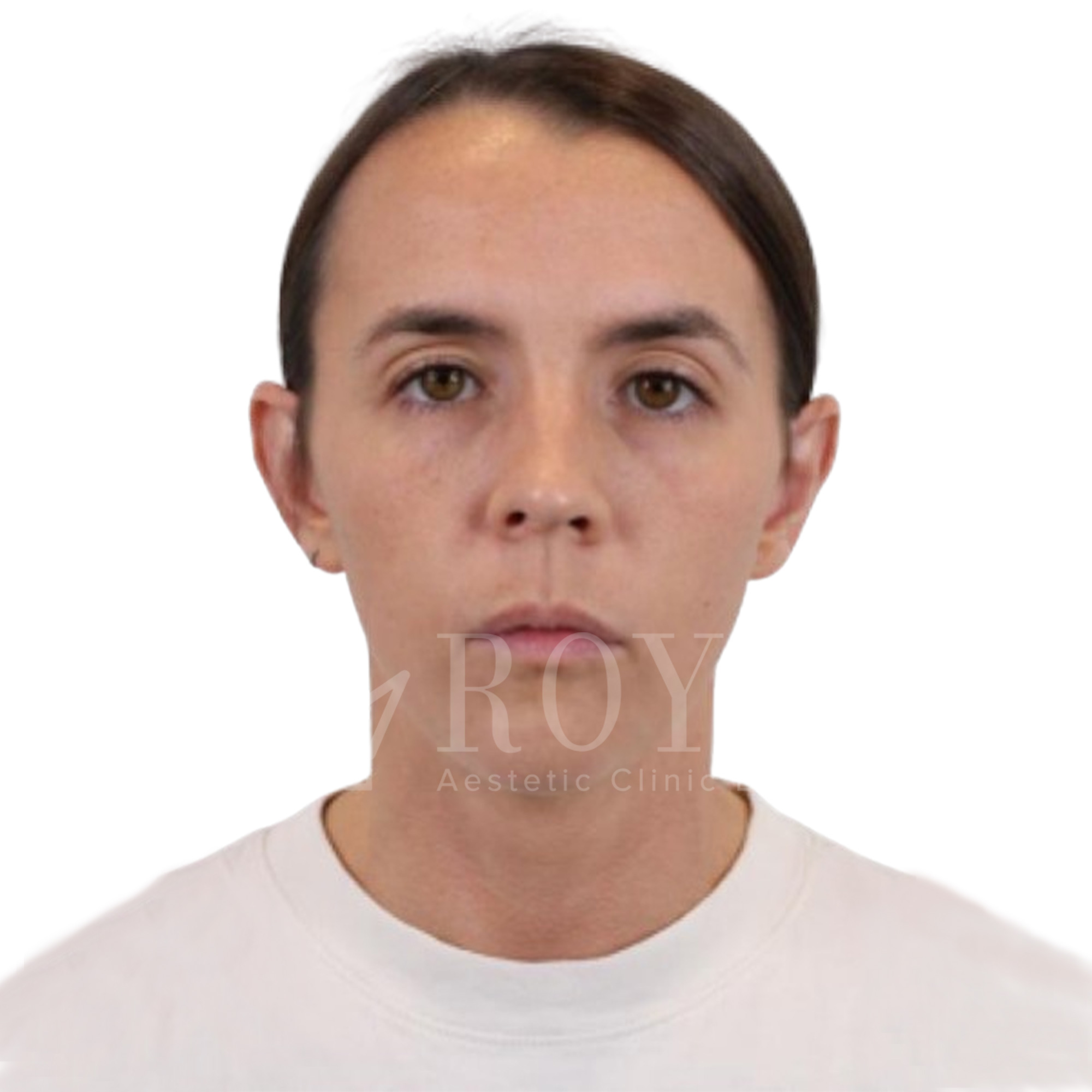 Plastic surgery | Before and after