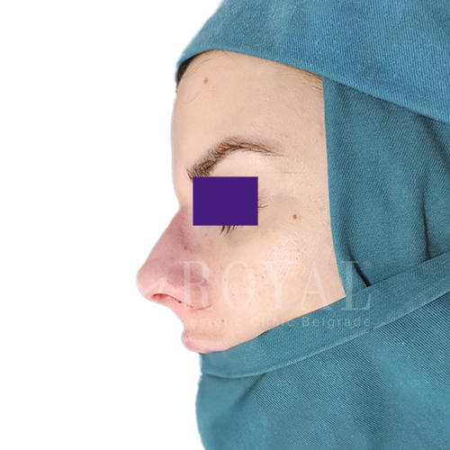 Plastic surgery | Before and after