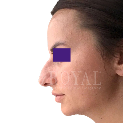 Plastic surgery | Before and after