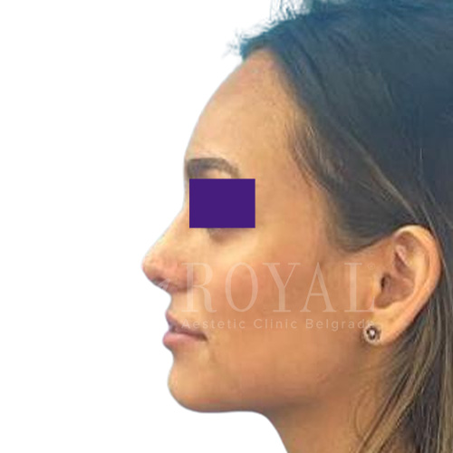 Plastic surgery | Before and after