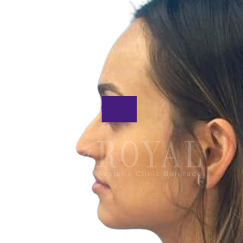 Plastic surgery | Before and after