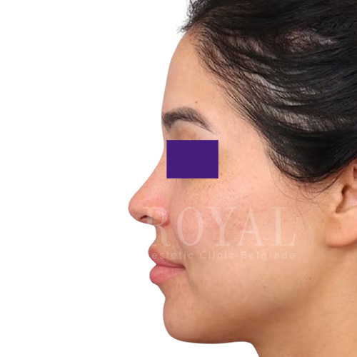 Plastic surgery | Before and after