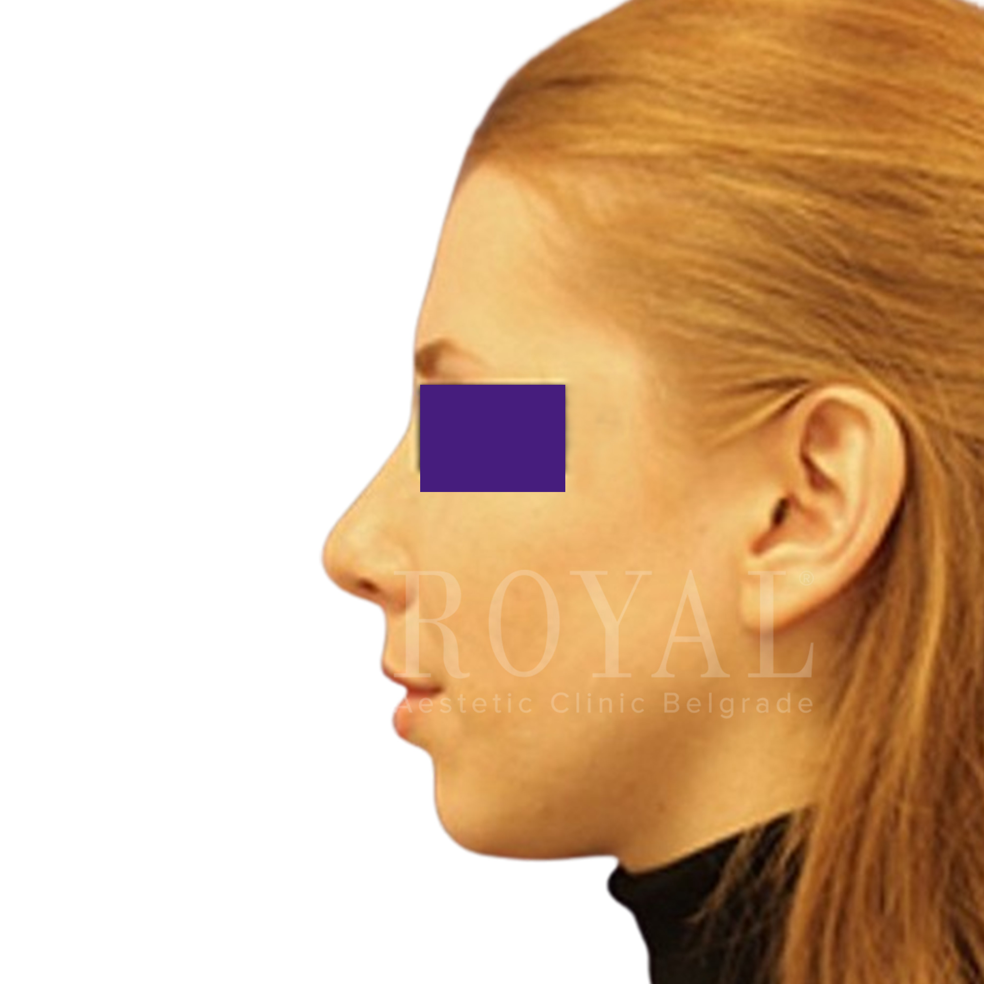 Plastic surgery | Before and after