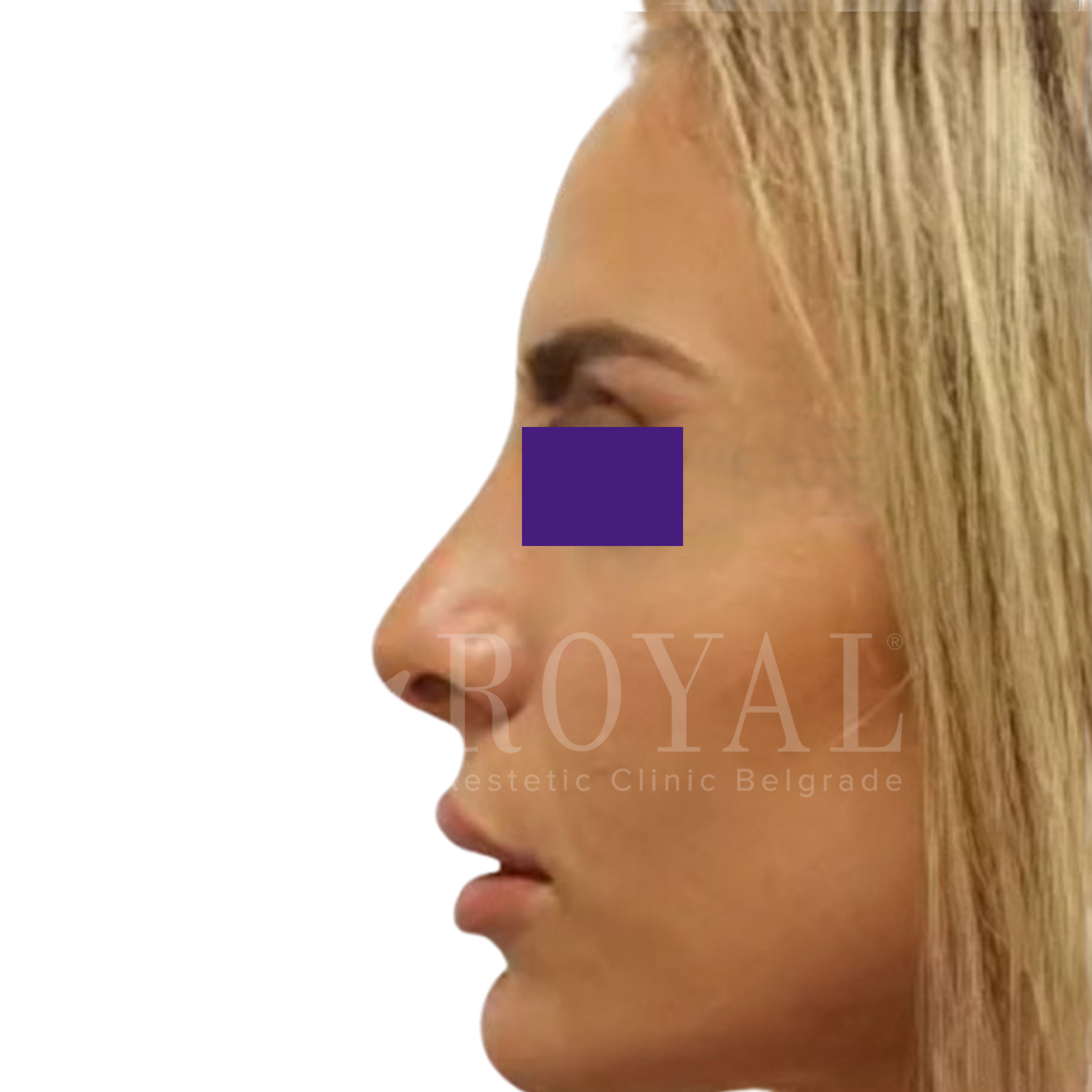Plastic surgery | Before and after