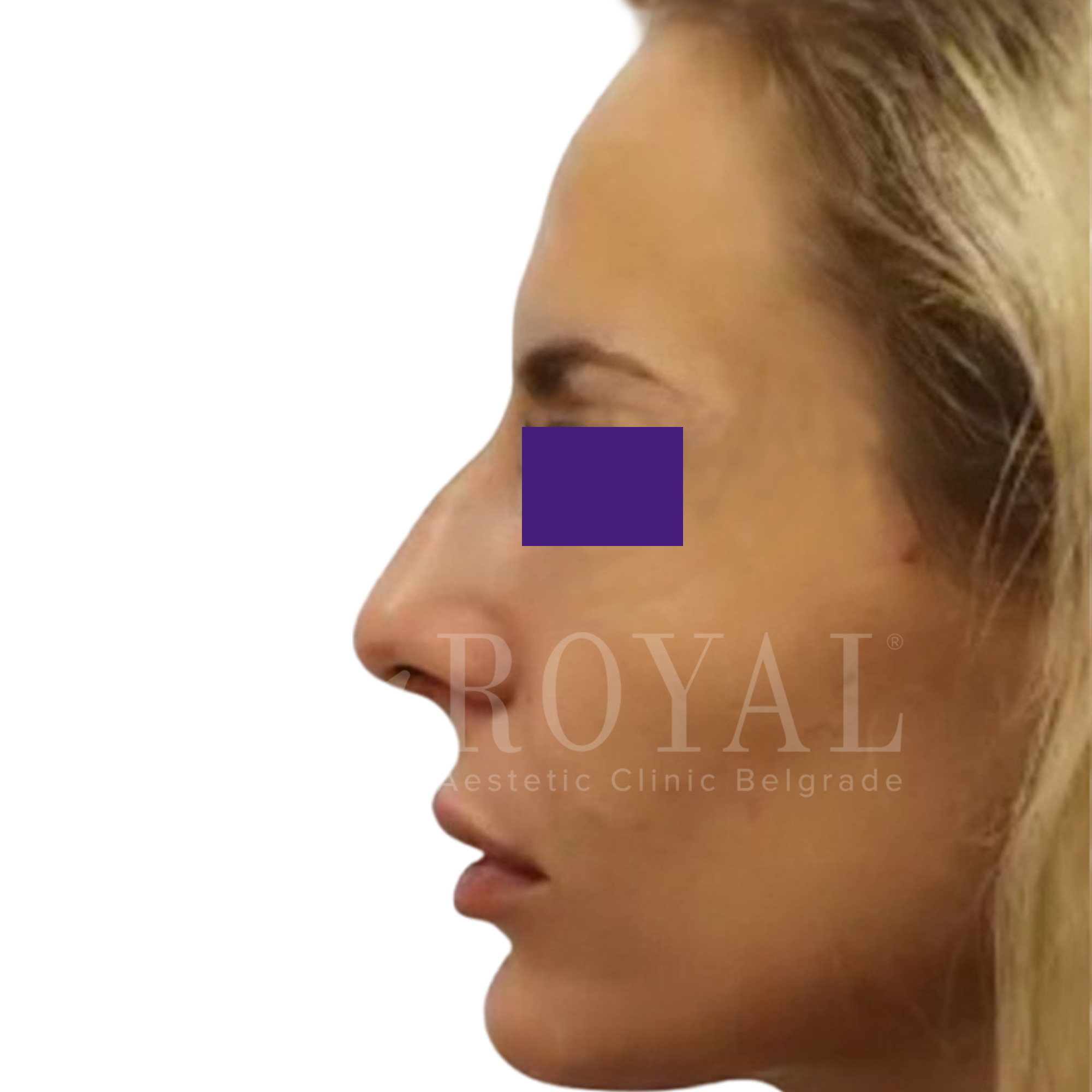 Plastic surgery | Before and after