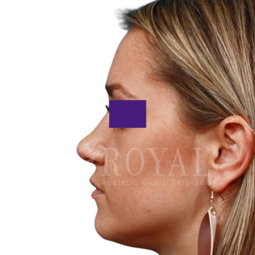 Plastic surgery | Before and after